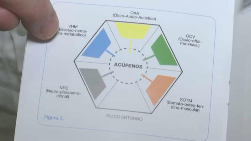 ACUFENS 1