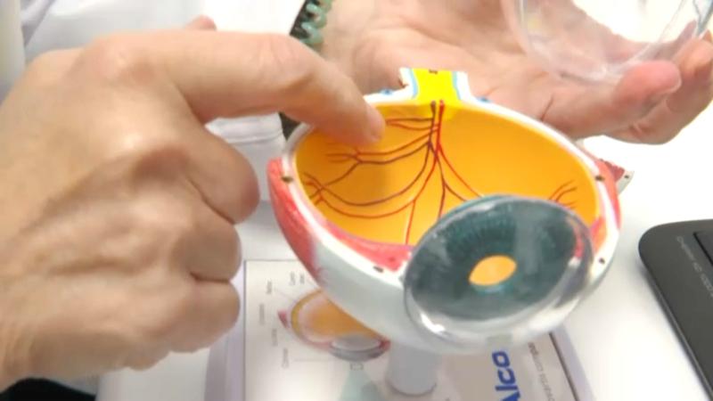 Protocol pioner a Can Ruti per accelerar el diagnòstic de l'ictus de retina, que pot provocar ceguesa