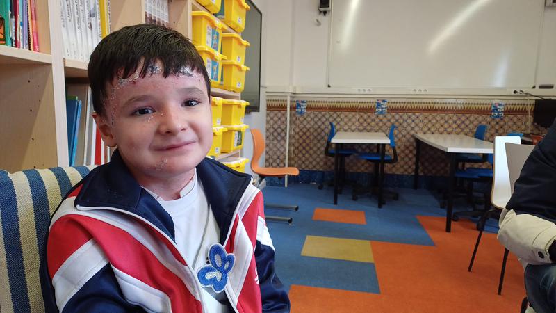 Conviure amb pell de papallona