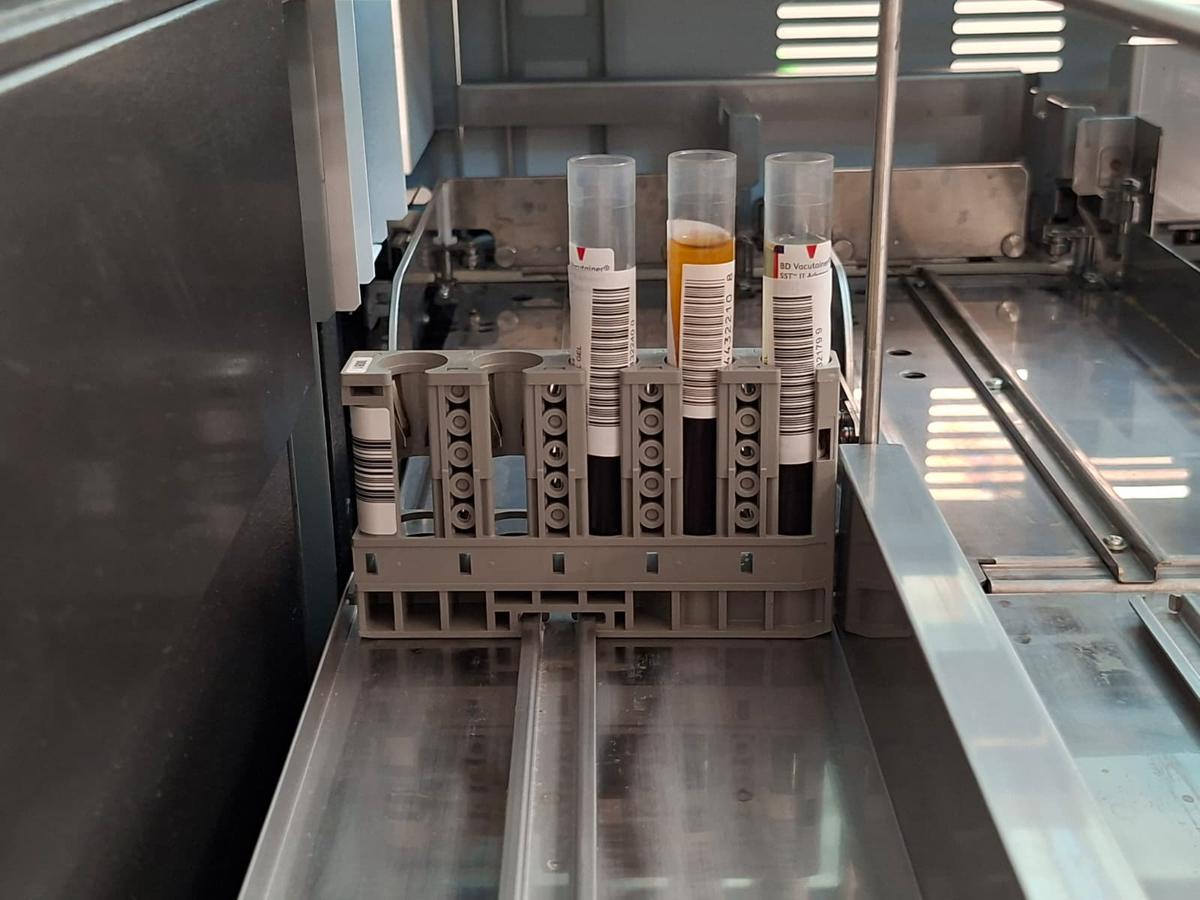 Mostres sang Laboratori BSA.jpeg