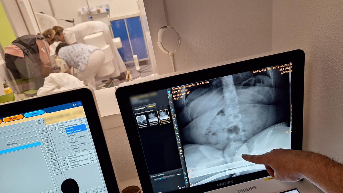 lhospital-germans-trias-i-pujol-es-el-primer-hospital-public-a-catalunya-en-incorporar-la-prova-de-videourodinamia